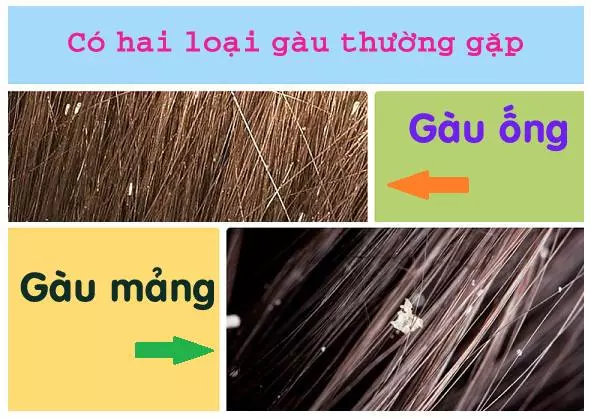 Có 2 loại gàu phổ biến