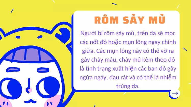 rom-say-mu-la-gi