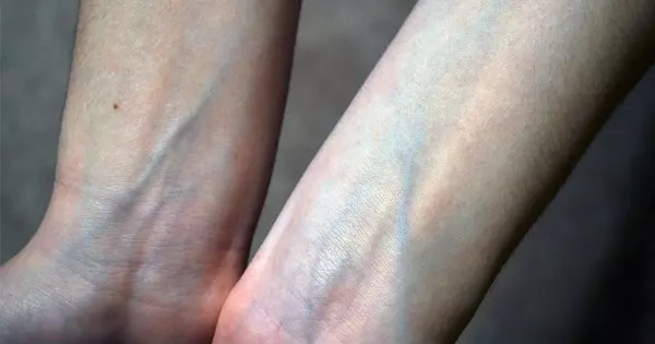 cach-xac-dinh-undertone-da