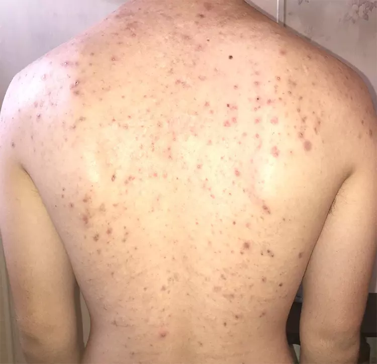 mun-lung-do-nong-gan