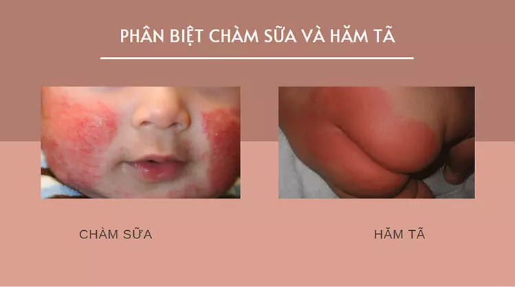 phan-biet-cham-sua-va-ham-ta