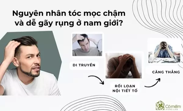 cách mọc tóc nhanh cho nam