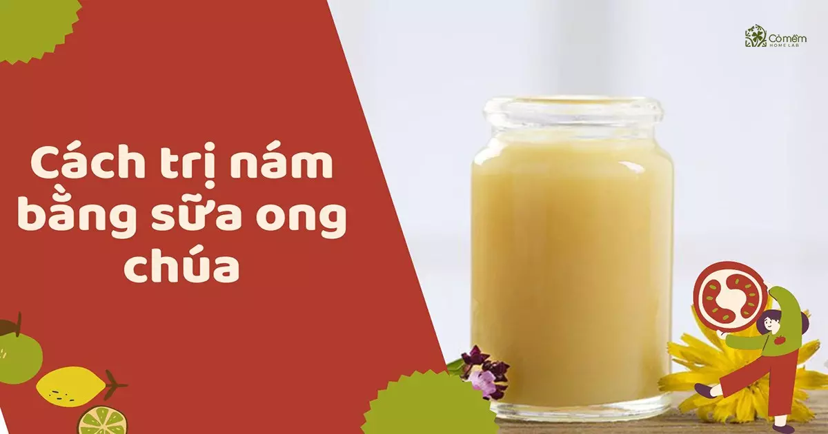 cách trị nám da mặt bằng thiên nhiên