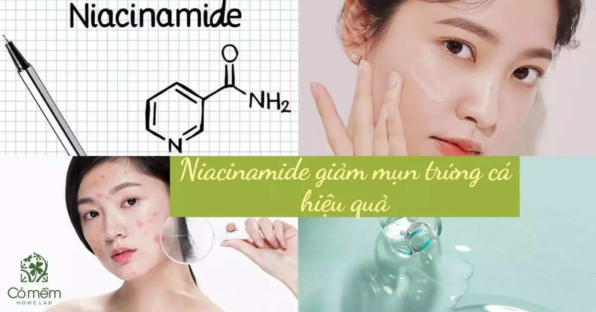 Niacinamide 