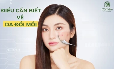 Những điều cần biết về da đồi mồi