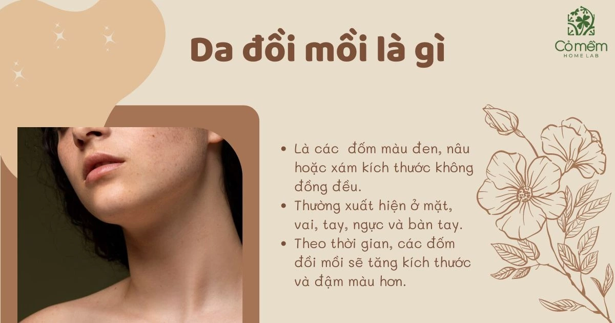 da đồi mồi 