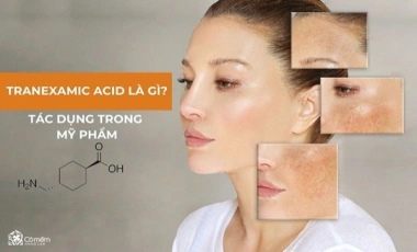 Tranexamic Acid Là Gì? Tác Dụng Của Tranexamic Acid Trong Mỹ Phẩm