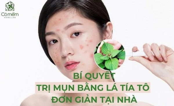 trị mụn bằng lá tía tô