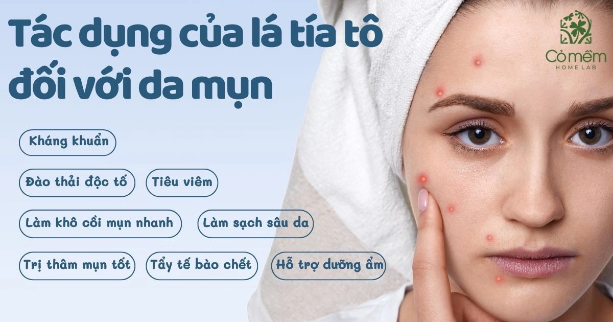 trị mụn bằng lá tía tô 