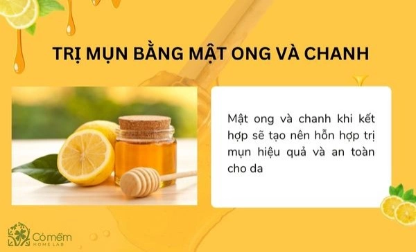 trị mụn bằng mật ong