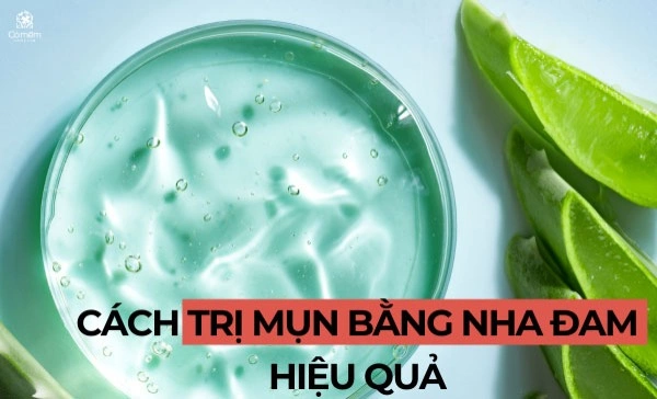 trị mụn bằng nha đam