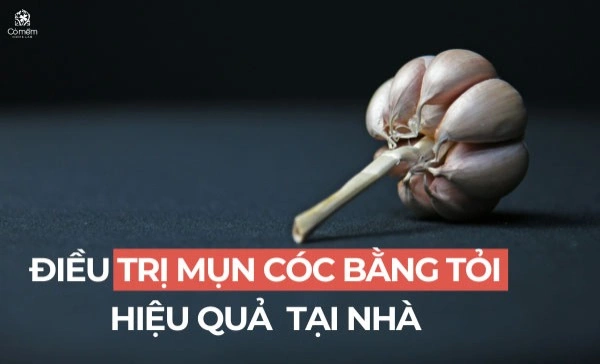 trị mụn cóc bằng tỏi