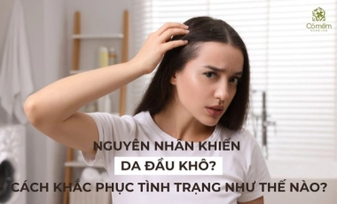 Nguyên Nhân Khiến Da Đầu Bị Khô? Khắc Phục Tình Trạng Da Đầu Khô Như Thế Nào?