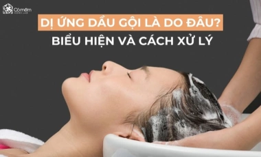 Dị Ứng Dầu Gội Là Do Đâu? Biểu Hiện Và Cách Xử Lý