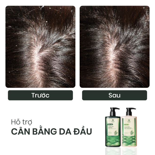 Combo Gội Xả Tóc Hương Thảo Giúp Sạch Gàu