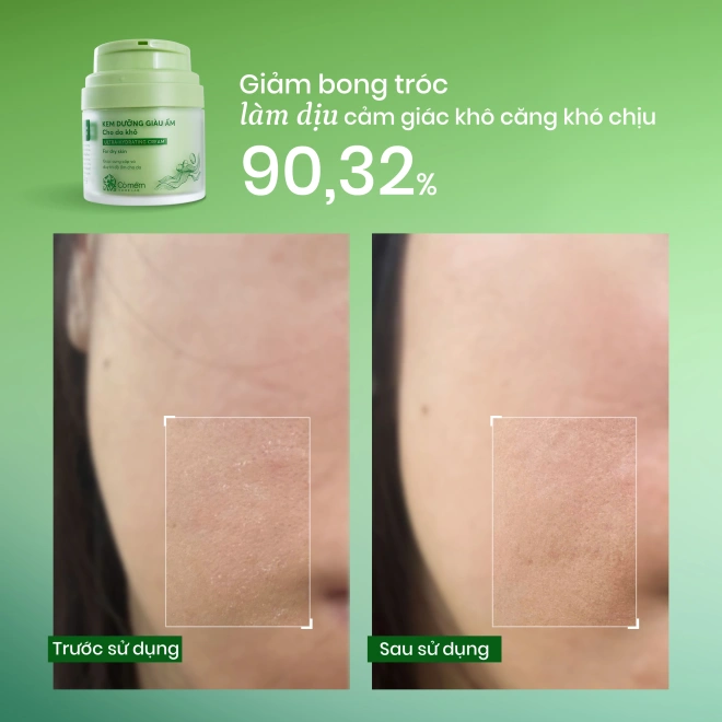 Kem Dưỡng Giàu Ẩm Cho Da Khô
