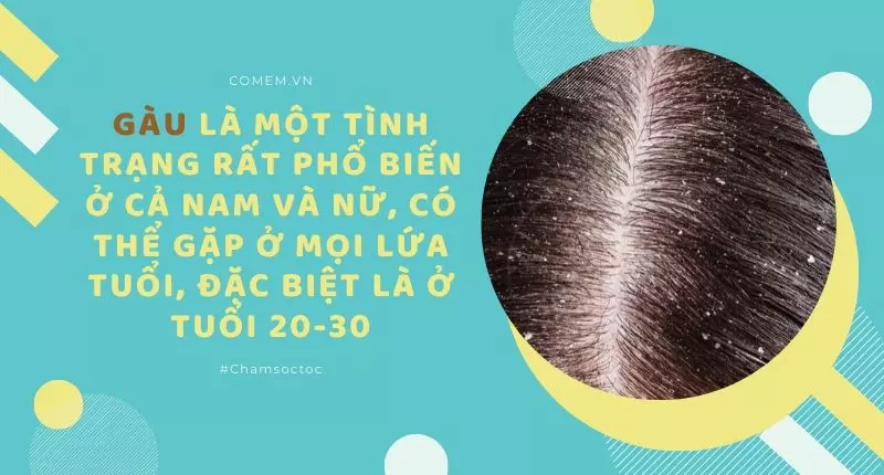 Những sự thật về gàu và Làm sao để đầu hết gàu?