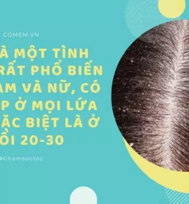 Những sự thật về gàu và Làm sao để đầu hết gàu?