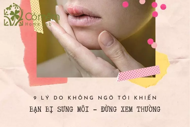 09 Lý do bị sưng môi - Đừng bỏ qua kẻo "hối hận" không kịp