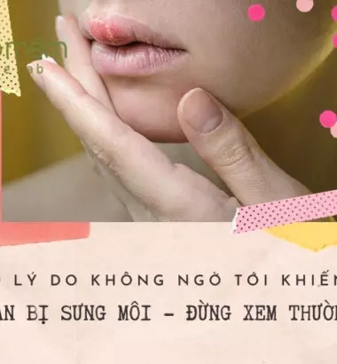09 Lý do bị sưng môi - Đừng bỏ qua kẻo "hối hận" không kịp