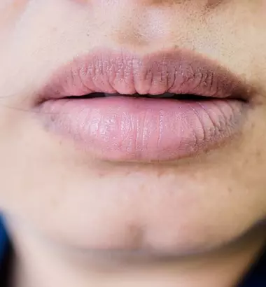 Môi thâm nên dùng son màu gì? 5 Thỏi son "vật báu là đây"