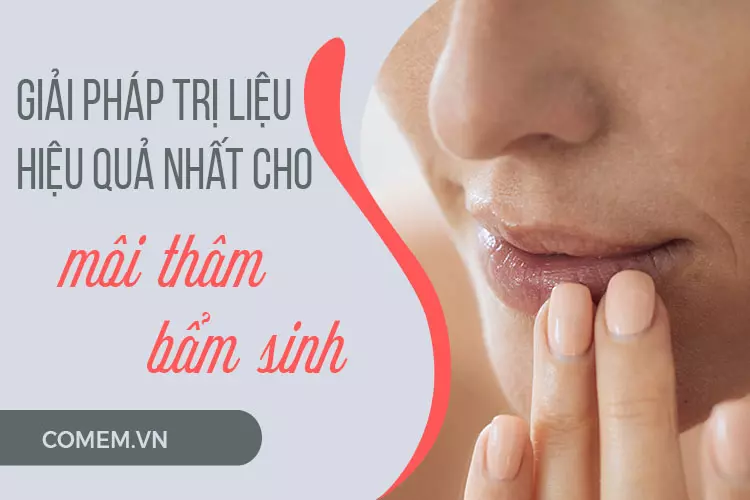 Cách trị môi thâm bẩm sinh tại nhà "ít tốn công nhất"