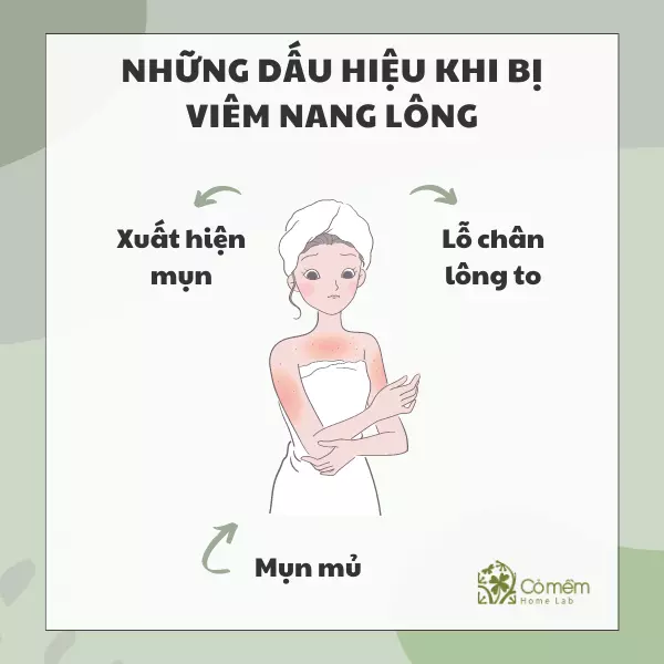 dấu hiệu viêm nang lông