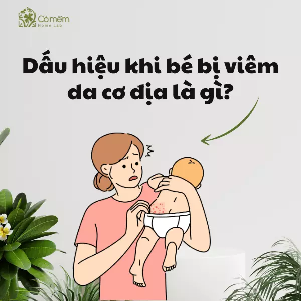 kem dưỡng ẩm cho bé bị viêm da cơ địa