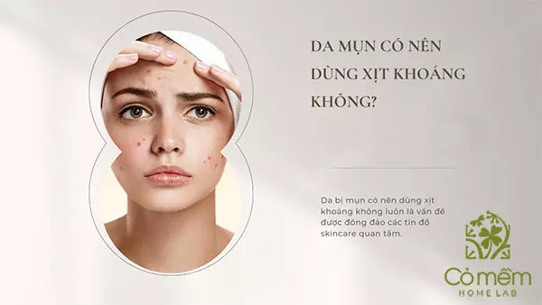 xịt khoáng da dầu mụn