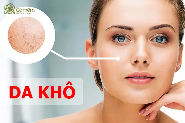 xịt khoáng cấp ẩm cho da khô