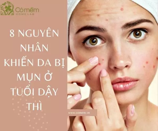 chăm sóc da mụn tuổi dậy thì