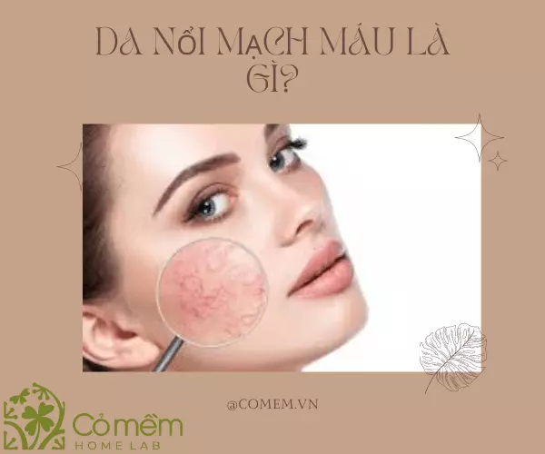 serum phục hồi da mỏng nổi mạch máu