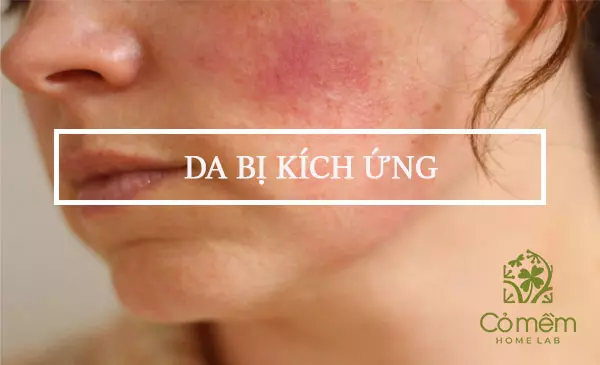 Dấu hiệu của da bị kích ứng và bí quyết phục hồi làn da