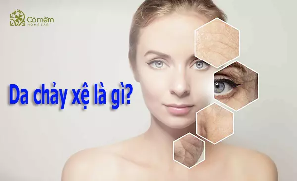 Da chảy xệ là gì? Nguyên nhân và cách chăm sóc giúp phục hồi làn da