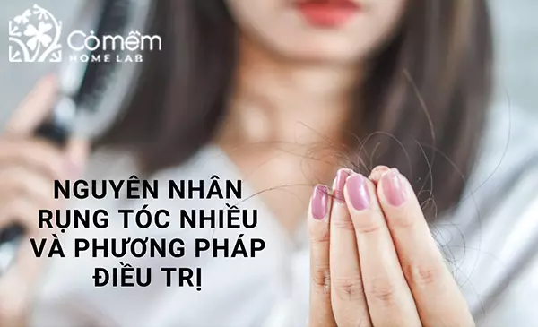 rụng tóc