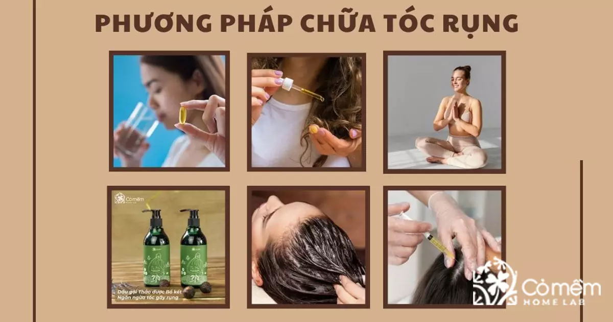 rụng tóc