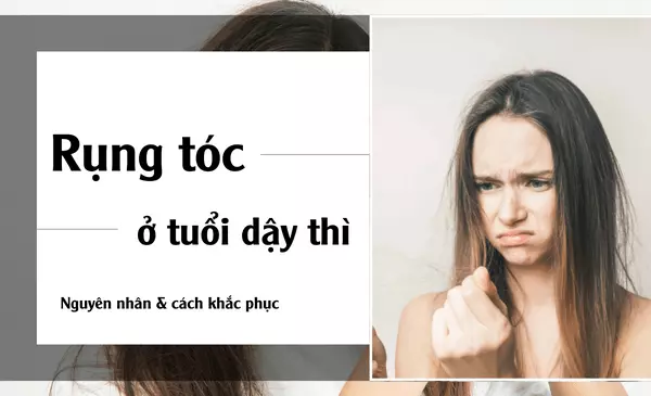 Nguyên nhân và cách khắc phục: Rụng tóc nhiều ở tuổi dậy thì