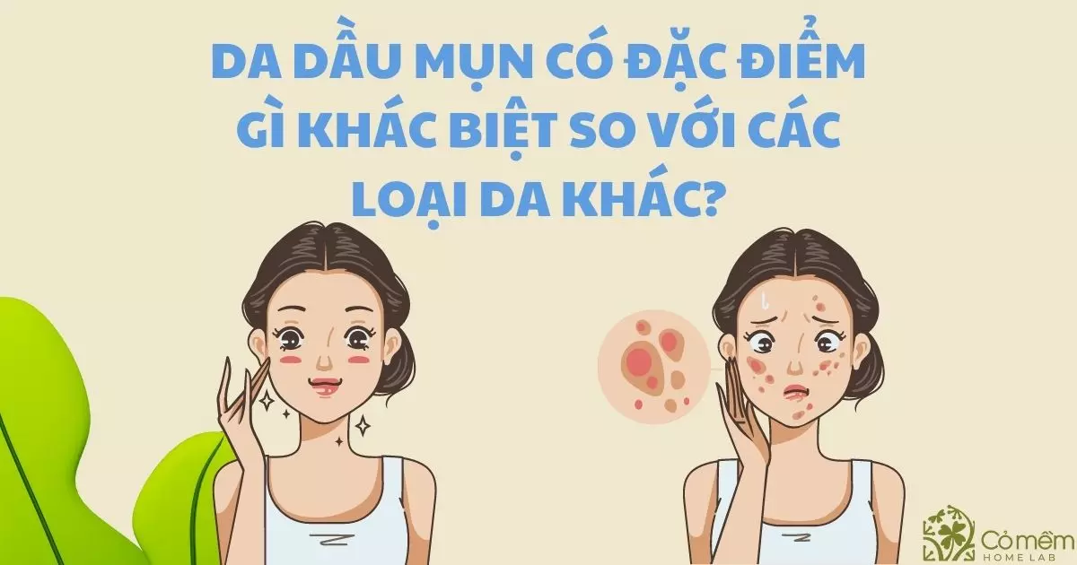 skincare cho da dầu mụn