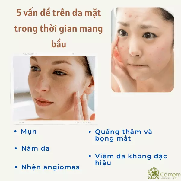 8 Bí Quyết Chăm Sóc Da Cho Bà Bầu An Toàn, Hiệu Quả