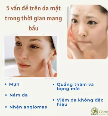 8 Bí Quyết Chăm Sóc Da Cho Bà Bầu An Toàn, Hiệu Quả