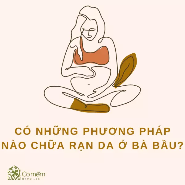 kem chống rạn da cho bà bầu tốt nhất