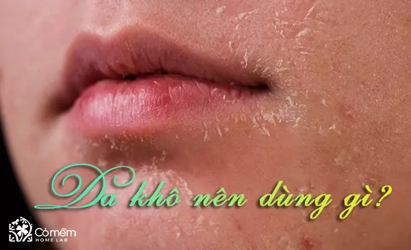 Da khô nên dùng gì? 10++ Mẹo giúp tạm biệt da khô mùa đông