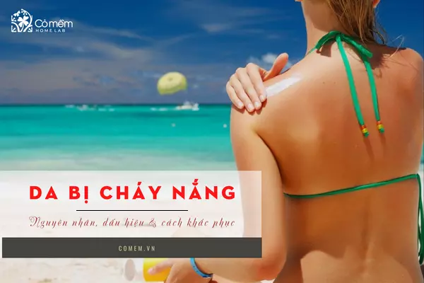 da bị cháy nắng