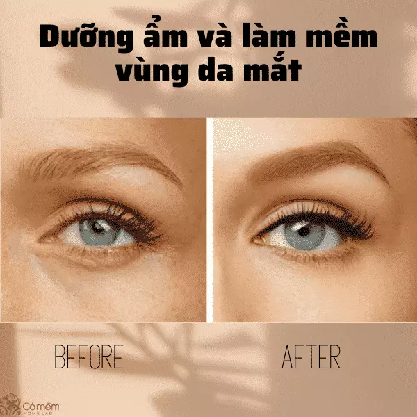 Dưỡng ẩm và làm mềm vùng da mắt 