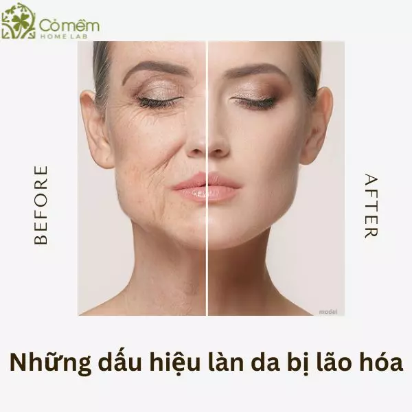 chống lão hóa da mặt