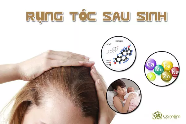 Rụng tóc sau sinh do thiếu máu