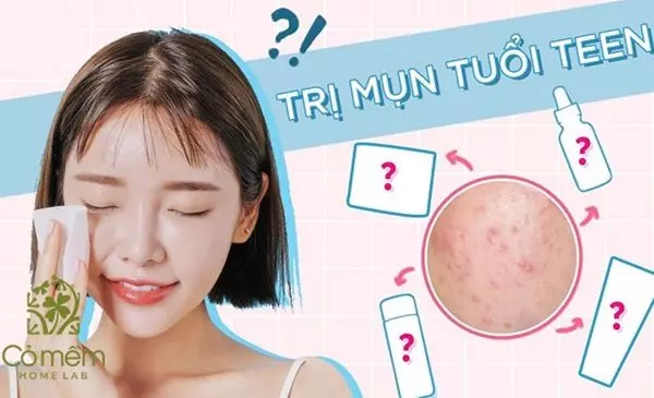 kem trị mụn cho tuổi dậy thì