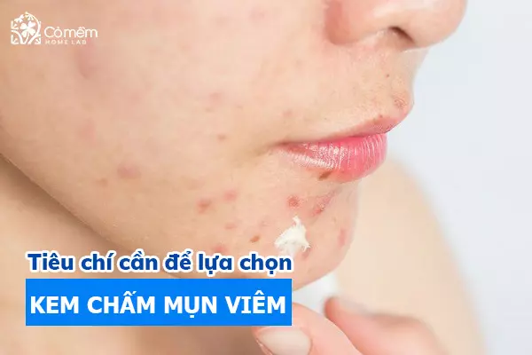 kem trị mụn viêm