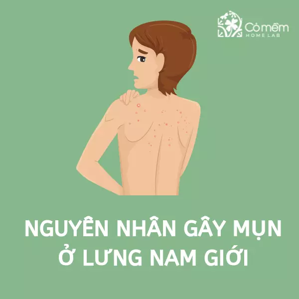 mụn lưng nam