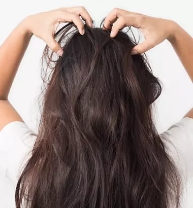 7 mẹo hay - Chấm dứt tình trạng ngứa da đầu và rụng tóc